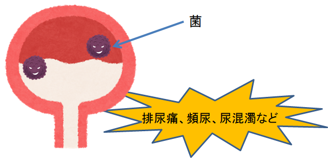 症 の 熱 感染 方 尿 路 出